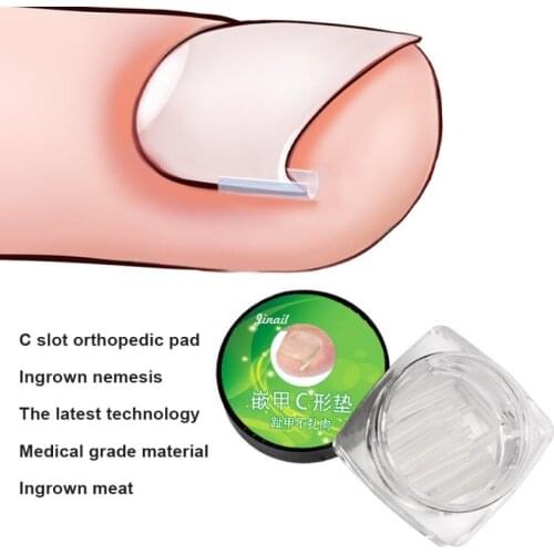 10 Piece Ingrown Pads Nail Groove Orthopedic Pads Nail Correction Devices Correction Treatments Sticker Patch Foot Care Tools