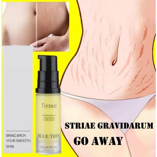 Remove Pregnancy Scars Acne Cream Maternity Repair Anti-Aging Anti Winkles Firming Body Creams Remove Stretch Marks Cream