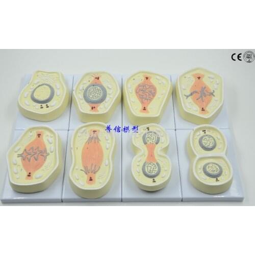 Free shipping&Cell mitosis model, biological teaching model, cell division, chromosome model,Medical anatomy