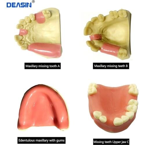 1 pc Dental Teeth Planting Practice Model Lower Jaw Implant Model With Soft Gum Dentist For Medical Dental Education