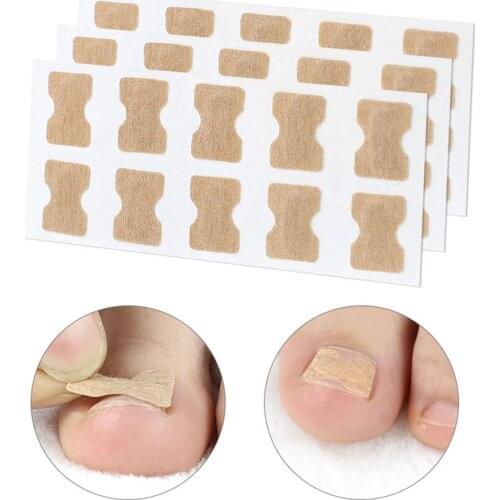 10/100PCS Ingrown Toenail Corrector Sticker Paronychia Treatment Fixer Recover Corrector Pedicure Foot Toe Nail Care Tool Set