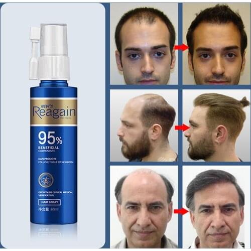 Hair Growth Essence Oil Anti Hair Loss Treatment for Beard Growth Oil Repair Damage Hair Roots Hair Care Products Hair Tonic