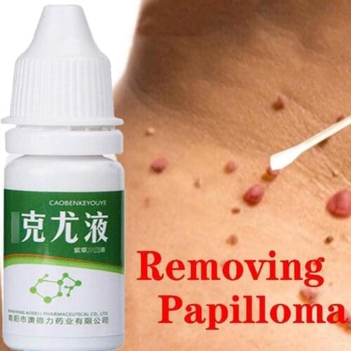 10ml Skin Tags Remove Liquid Treatment Foot Corn Papillomas Removal Warts Skin Neck Armpit Plantar Mole Tag N4F8