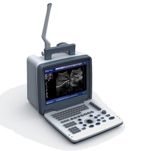 Full Digital LED Portable Ultrasound doppler machine Laptop Doppler Ultrasonic Diagnostic System