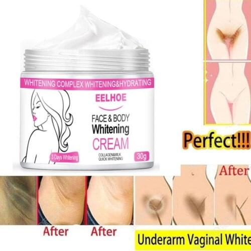 30g Whitening Cream Face Body Moisturizer Brighten Dark Skin Neck Under Arms Armpit Bikini Private Part Knees Elbow Between Legs
