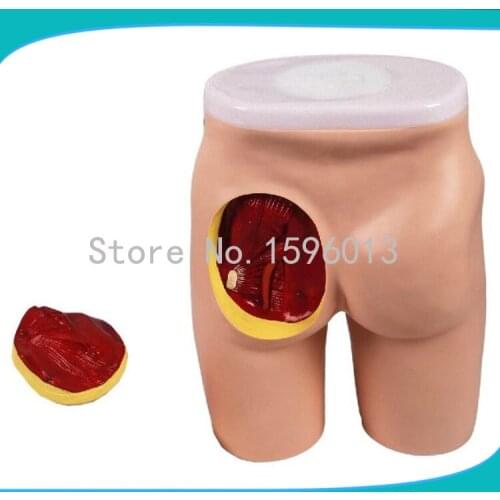 Buttocks Intramuscular Injection And Anatomic Structure Model,Buttocks anatomical model