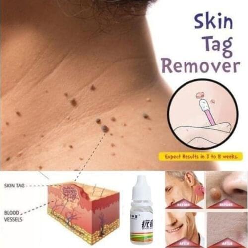 CHYDDCC Facial Care Tools