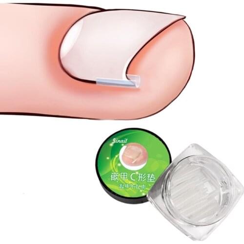 10pcs/set Orthopedic Pad Ingrown Toenail Correcting Tool Pain Care Ingrowing Nail Corrector Nail Treatment Used For Home
