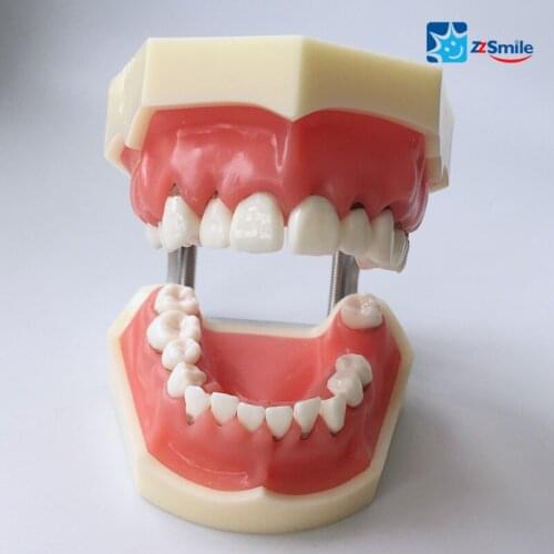 Dental Teeth Study Model/Periodontal Disease Model M4024