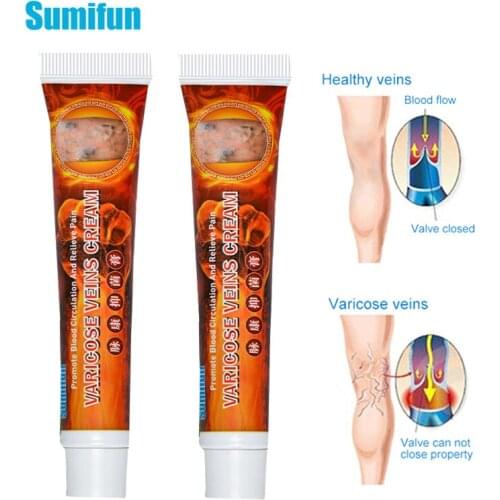 2pcs Sumifun Varicose Veins Cream Varicosity Angiitis Remedy Ointment Relief Veins Pain Phlebitis Spider legs Health Care D3174