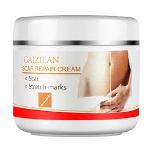 Scar Repaire Cream Stretch Marks Remover Cream Eliminate Pregnancy Scars Maternity Repair Anti Winkle Skin Firming Treatment