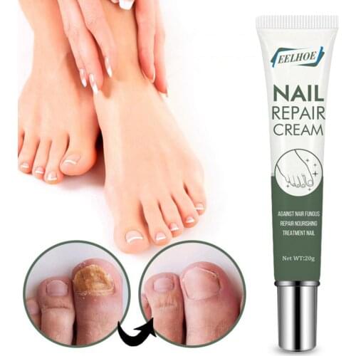 Skin Friendly 20g/Bottle Practical Nail Fungus Repair Ointment Universal Nail Repair Ointment Effective for Home