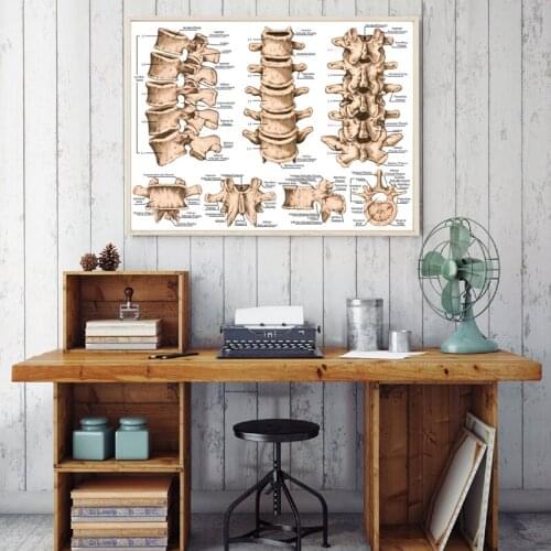 Lumbar Spine Structure Chart Prints Medicine Educational Poster Human Skeletal System Doctor Office Wall Decor