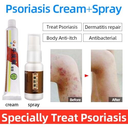 Psoriasis Cream Eczema Pruritus Ointment Chinese Herbal Material Anti-itch Psoriasis Dermatitis Plaster Urticaria Skin Allergy