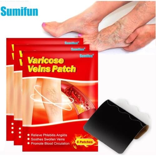 6pcs Varicose Veins Plaster Angiitis Removal Sticker Vasculitis Phlebitis Spider Leg Treatment Herbal Medical Patch Skin Care