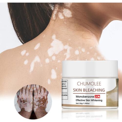 Body Whitening Cream Bleaching Face Body Vitiligo Underarm Armpit Lightening Cream Knuckle Legs Knees Private Parts Body lotion