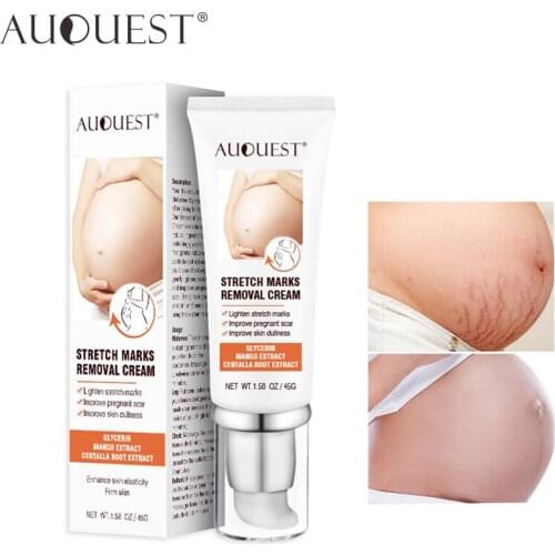 Крема от растяжек Gecomo China At AliExpress