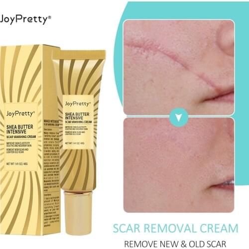 Removal Scar Repair Gel Remove Stretch Marks Burn Surgical Scars Pigmentation Acne Cream Nourish Protect Natural Ingredient Care
