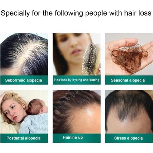 50ML Hair Nutrient Solution Anti Hair Loss Hair Growth Frizzy Hair Care Repair Tool Spray Damaged Hair Hair Serum Dry Preve L0P0