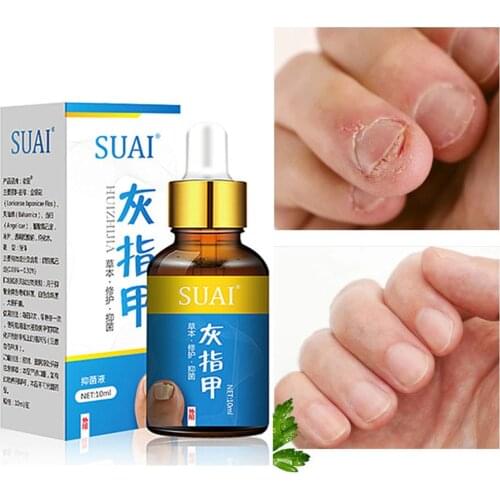 Onychomycosis Bright Nail Antibacterial Solution Foot Care Essence Nail Whitening Toe Fungus Removal Liquid