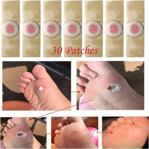 30Pcs Foot Care Sticker Medical Patch Foot Corn Removal Pads Warts Thorn Curative Patches Calluses Remove Callosity Detox
