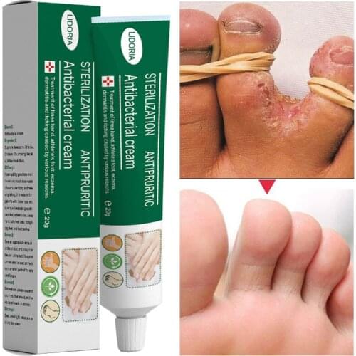 DEleventh Ointments For Feet China