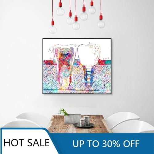 Wall Art Canvas Painting Posters Prints Dental Wall Decor Tooth Implant Dentist Medicine Hygienist Tooth Clinic Room Decor
