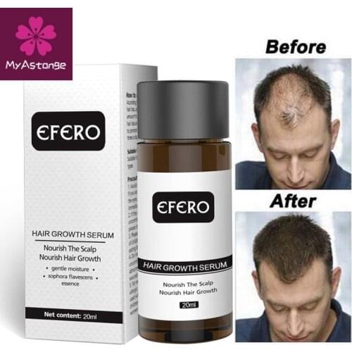 EFERO Fast Powerful Hair Growth Oil Hair Loss Products Essential Oil Regrow Dense Hair Restoration Growing Serum Hair Care 20ml