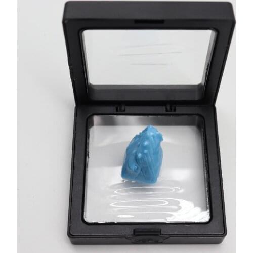 Blue Whale Tail Egypti Design Resin Keycap For Cherry Mx Switch Mechanical Keyboard ESC ENTER ARROW DIY Decoration Key Cap