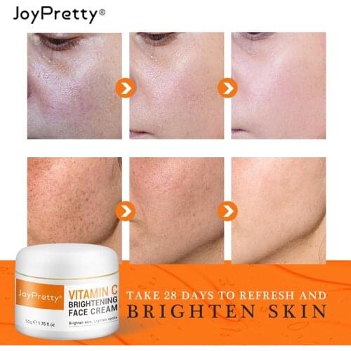 Effective Whitening Vitamin C Freckle Cream Remove Melasma Acne Spot Pigment Dark Spots Pigmentation Moisturizing Skin Care 50g