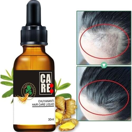 Ginger Hair Growth Serum Hair Loss Treatment Spray Effective Germinal Hair Growth Essential Oil Men Women Hair Care 30Ml