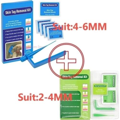 Home Use micro skin tag remover wart tag removal equipment tag treatment band kit easy to clean skin care mole Acne Remover tool
