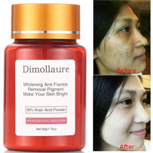 Dimollaure 50g pure 99% Kojic Acid scar removal Freckle melasma Acne scar pigment Melanin sunburn Dimore face whitening cream