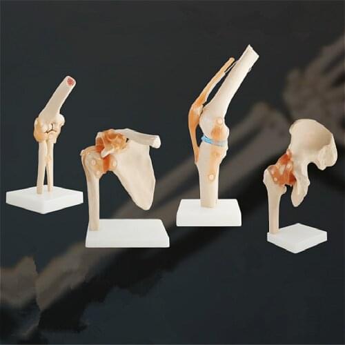 Medical Model Functional Model Of Human Knee Joint Shoulder Joint Elbow Joint