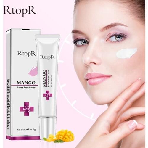 Mango Repair Acne Cream Anti Spots Acne Treatment Scar Blackhead Cream Shrink Pores Whitening Moisturizing Face Skin Care
