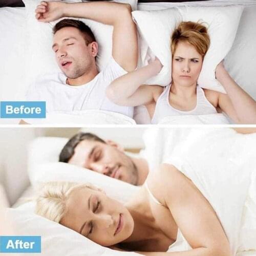 1pc Rhinitis Sprays Stop Snoring Chronic Sinusitis Treatment Products Chinese Spray Care Herb Health Nasal Nose N8B2