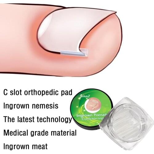10 Pcs Ingrown Pads Foot Care Toe Nail Ingrown Correction Sticker Paronychia Repair Pedicure Toe Nail Fingernail Care Tools