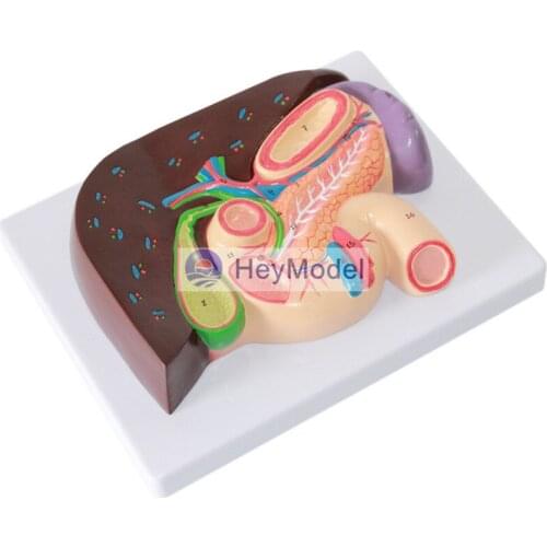 HeyModel Hepatobiliary duodenum Gastric section model