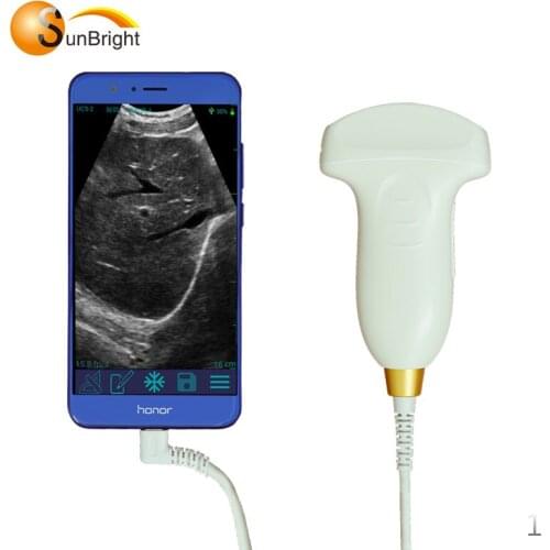 128 Elements Wifi ultrasound USG / Wireless Ultrasound Probe For IOS Android Mobile Device