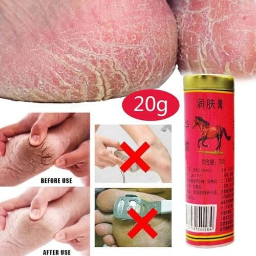 1Pcs Horse Oil Hand Cream Anti-Chapping Ointment Prevent Dry Skin Moisturizing Ointment For Hand Finger Foot Skin Care 20g