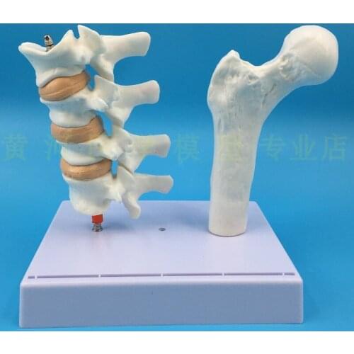 Human osteoporosis health and disease comparison model skeleton femur face medical display model