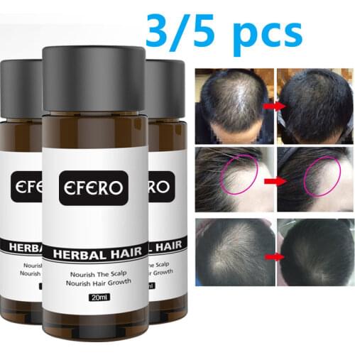 EFERO Hair Loss Serum Essential Oils Dense Hair Growth Serum Hair Care Prevent Baldness Anti-Hair Loss Serum 20ml Smooth
