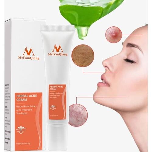 15g Acne Scar Removal Cream Pimples Stretch Marks Face Gel Remove Acne Smoothing Whitening Moisturizing Body Skin Care