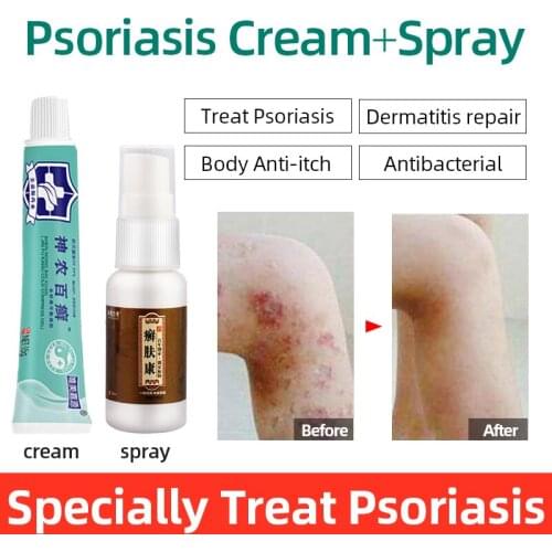 Antibacterial Psoriasis Itching Ointment Allergy Dermatitis Eczema Cream Repair Body Eczema Psoriasis Skin Care External Use GEL