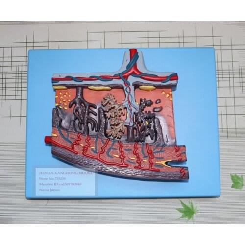 Placenta Tissue Model,Placenta Amplification Model,Female Placenta Tissue Structure Model