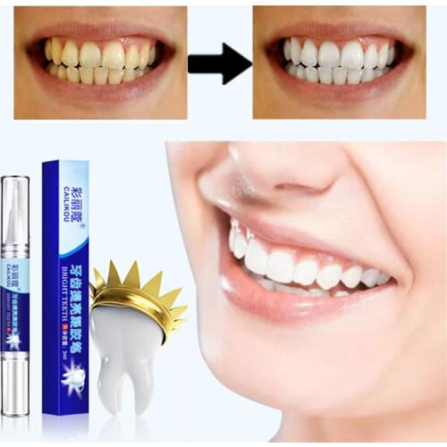 Effective Teeth Whitening High Strength Whitening Gel Oral Hygiene Tooth Stains Tartar Tea Stains Tooth Care 3ML