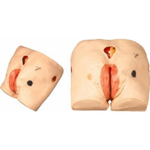 Chinon Senior Decubitus Pressure Ulcers Bedsore Nursing Model Medicine Student Medical Science Teaching Sources Supply BIX-H10