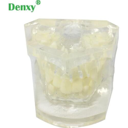 Denxy Dental Orthodontic Teeth model Dental Disease Tooth Model New Dentist Traning In The School Ortho dontic brackets