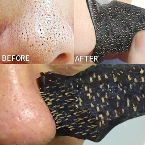 Effective Blackheads Removal Mask Nose Purifying Deep Cleaning 10pcs Black Pore Contraction T District Care Water Hydrating