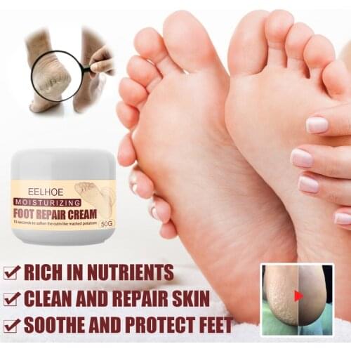 Anti Dry Skin Cream Dead Skin Hands Feet Care ​Crack Cream Heel Chapped Peeling Foot Repair Hand Foot Peeling Cracking TSLM1